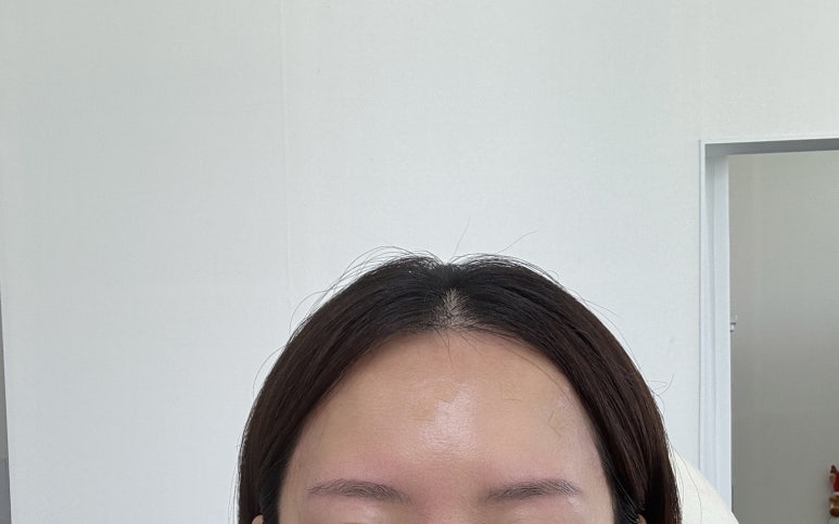 오즈헤어라인 이미지