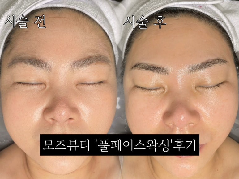 모즈뷰티 이미지
