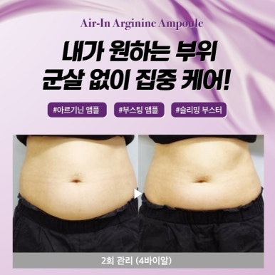 보에스테틱 이미지