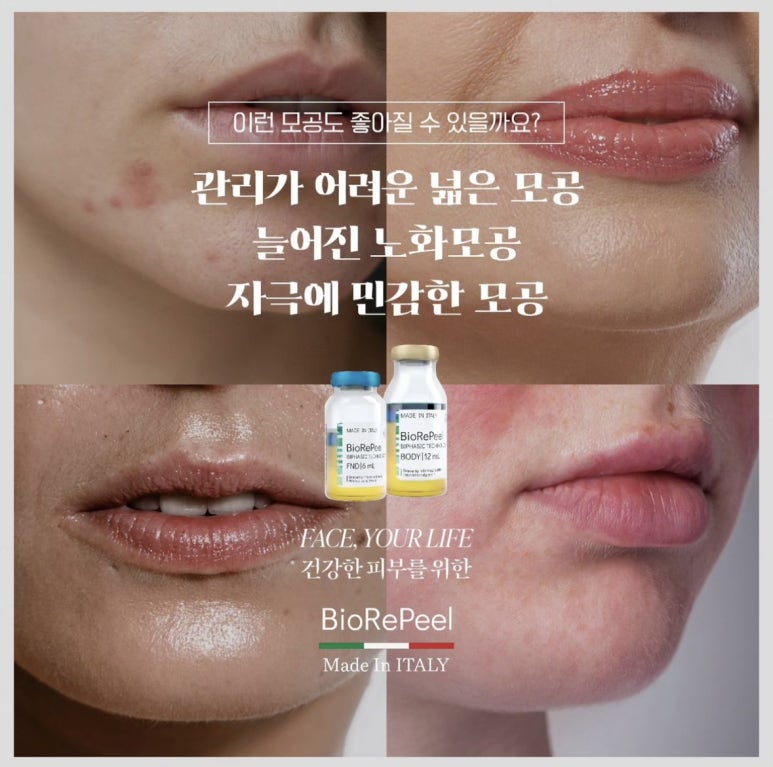 제이스킨 이미지
