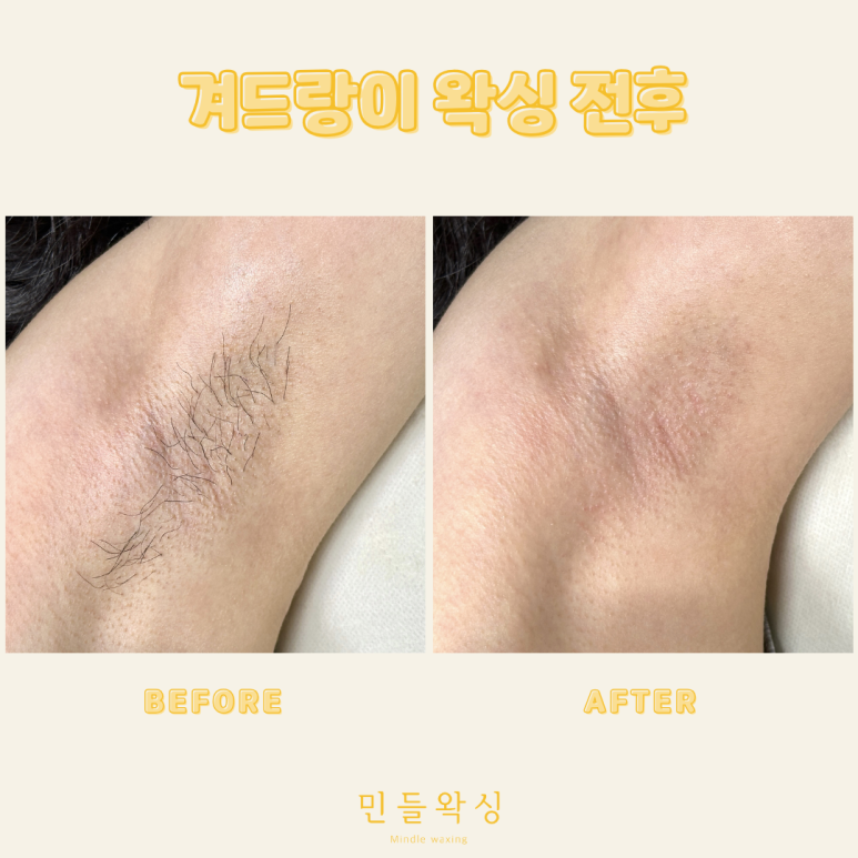 민들왁싱 이미지