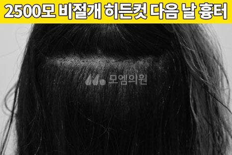 중앙헤어라인 이미지
