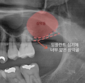 서울바른정치과 이미지