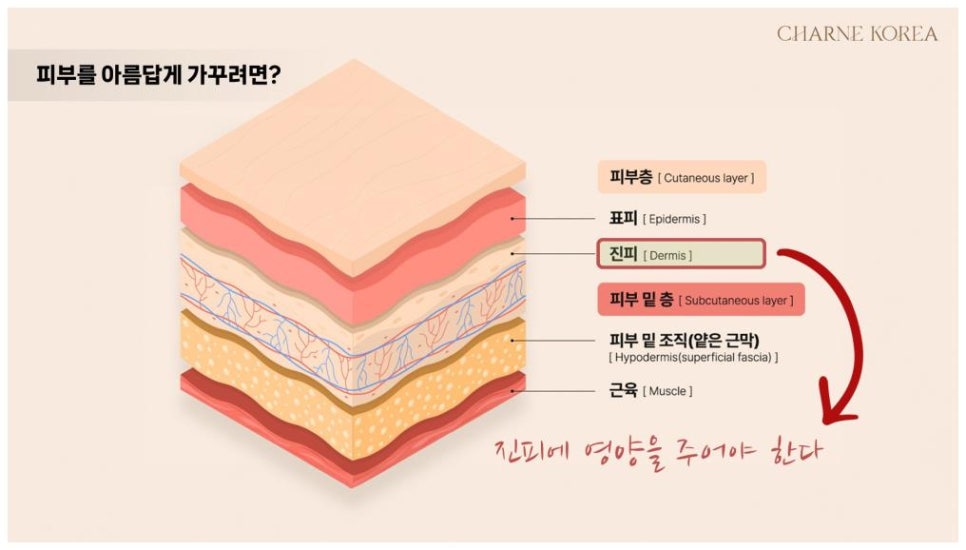 샤르네 이미지