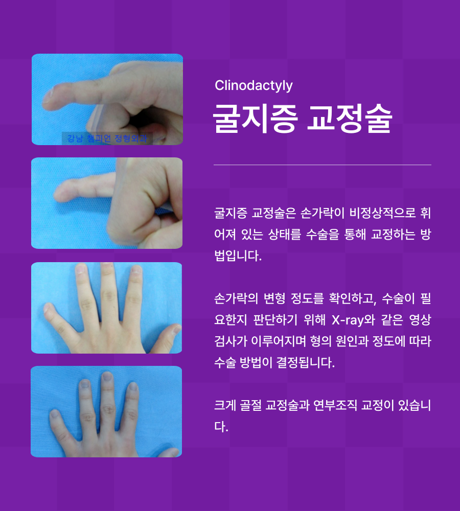 강남챔피언정형외과의원 이미지
