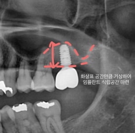 서울바른정치과 이미지