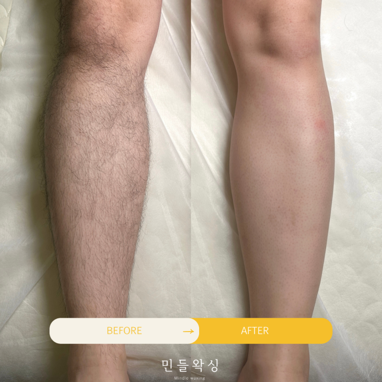 민들왁싱 이미지