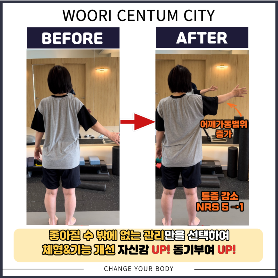 바디케어체형관리 이미지