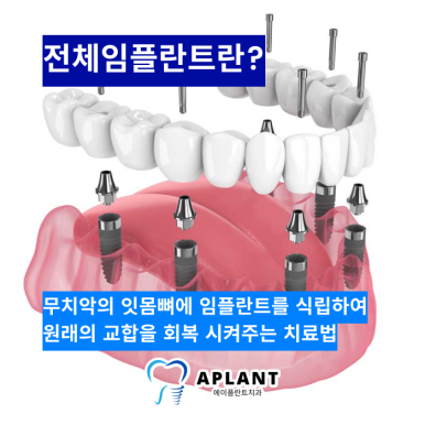 에이플란트치과의원 이미지