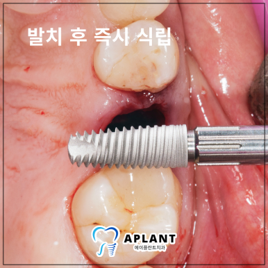 에이플란트치과의원 이미지