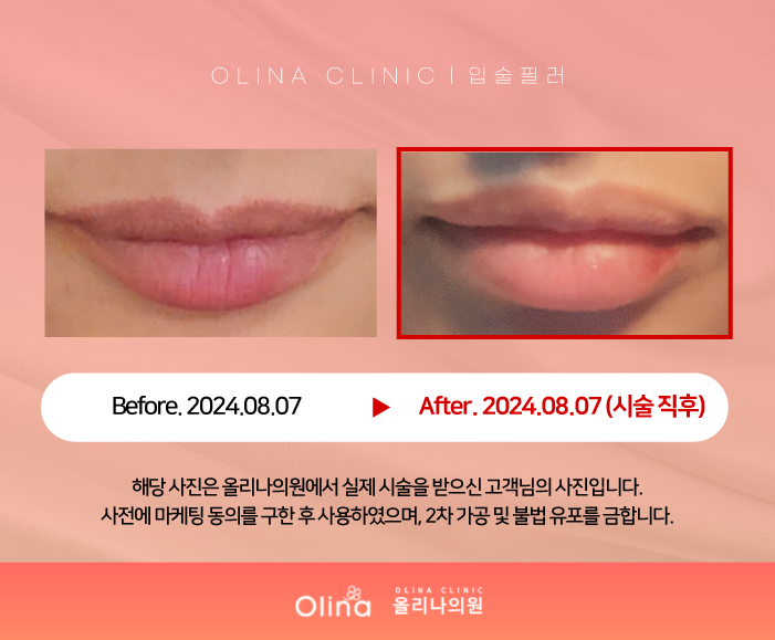 올리나의원 이미지