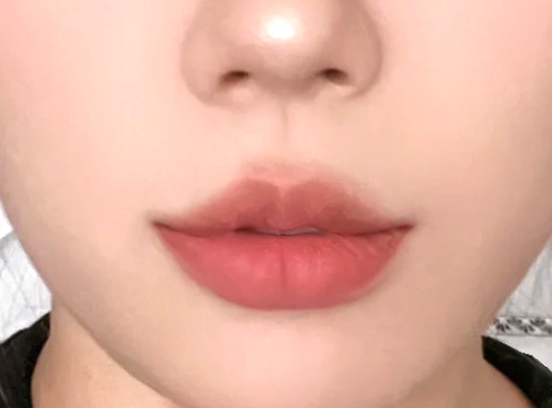 올리나의원 이미지