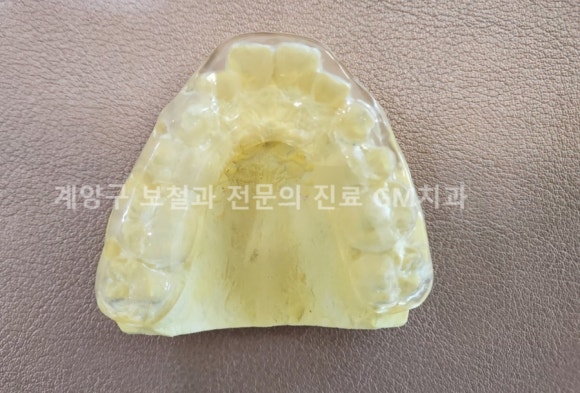 GM치과 이미지