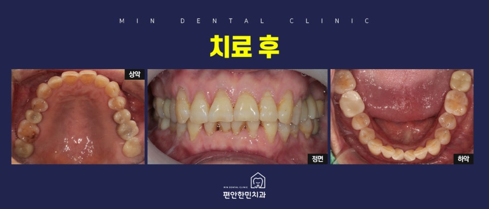 편안한민치과 이미지