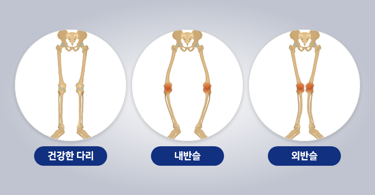 좋은교정 이미지