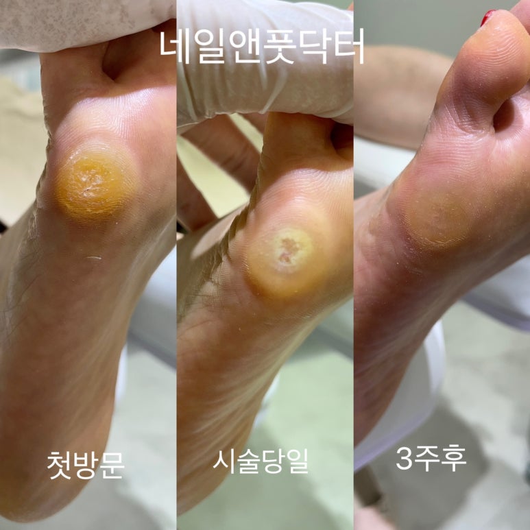 네일앤풋닥터 이미지