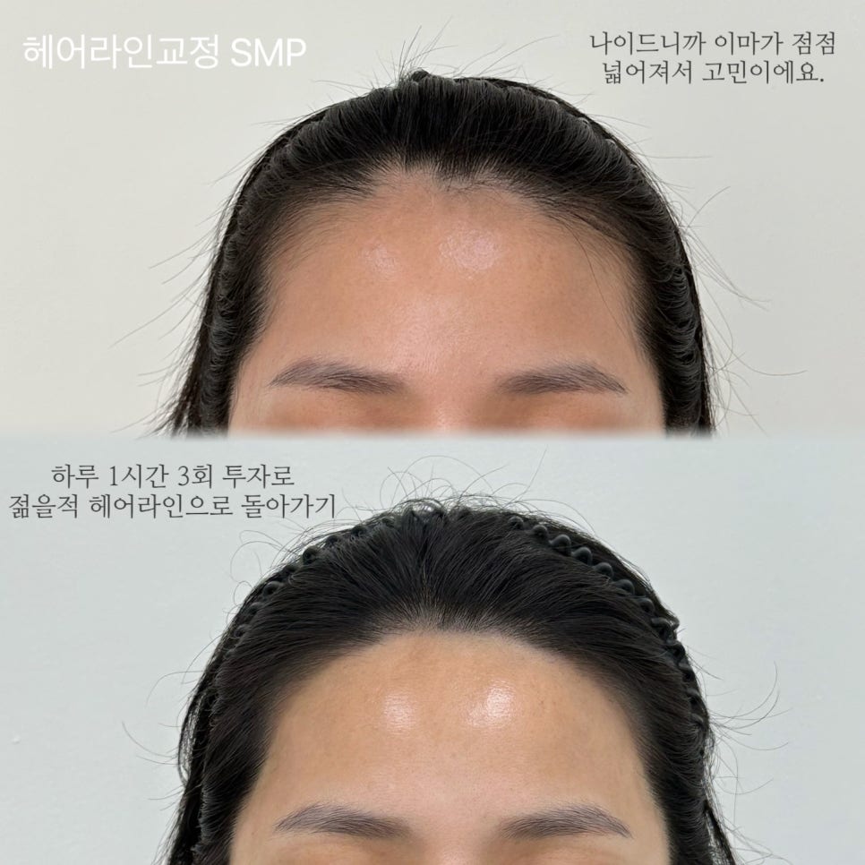 라인헤어 이미지