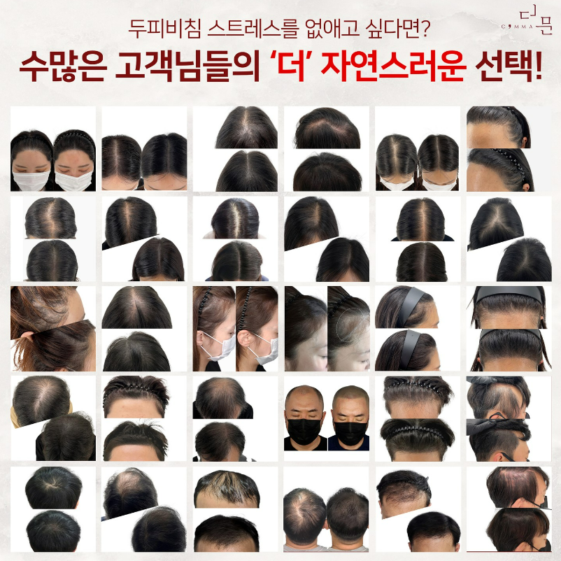콤마더문 이미지