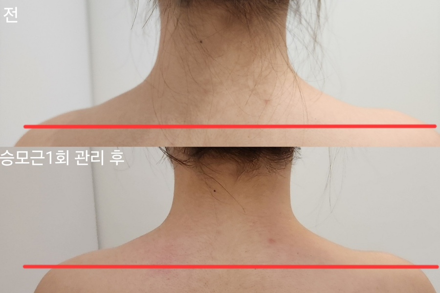 더맑은스킨 인천검단신도시점 이미지