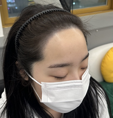 조헤어라인 이미지