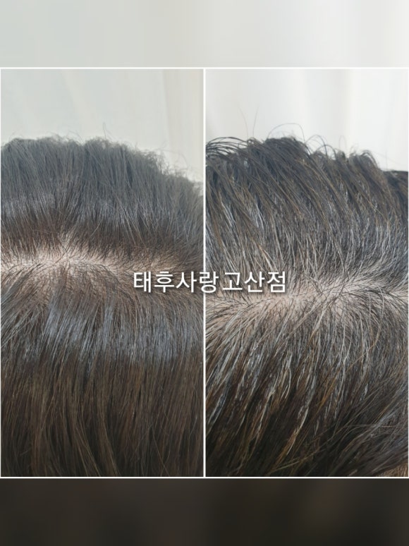 태후사랑 피부사랑 이미지