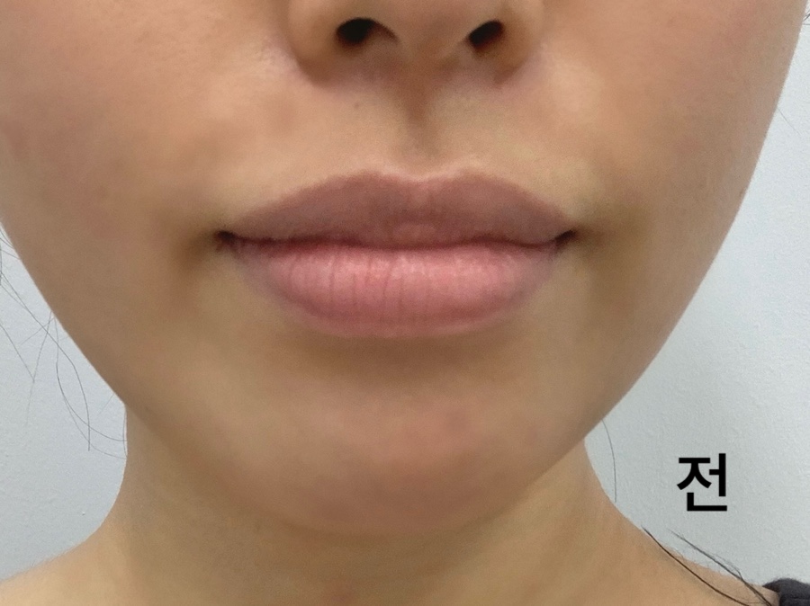퍼스널픽디자인 이미지