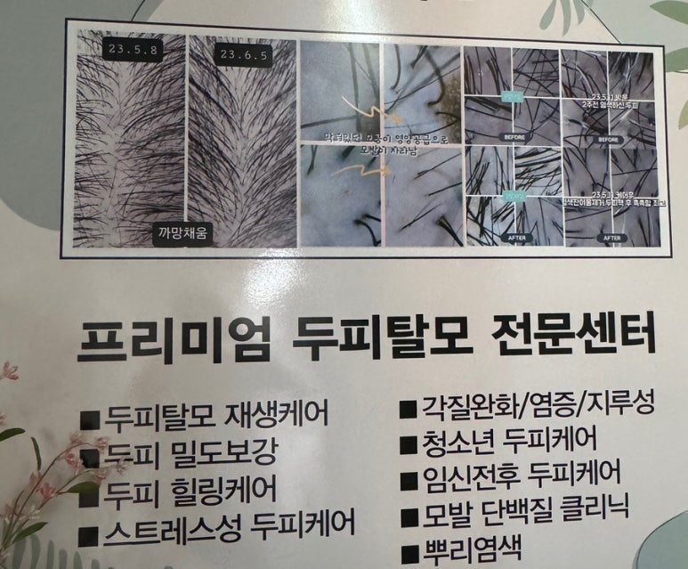 까망채움스칼프 이미지