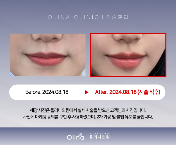 올리나의원 이미지