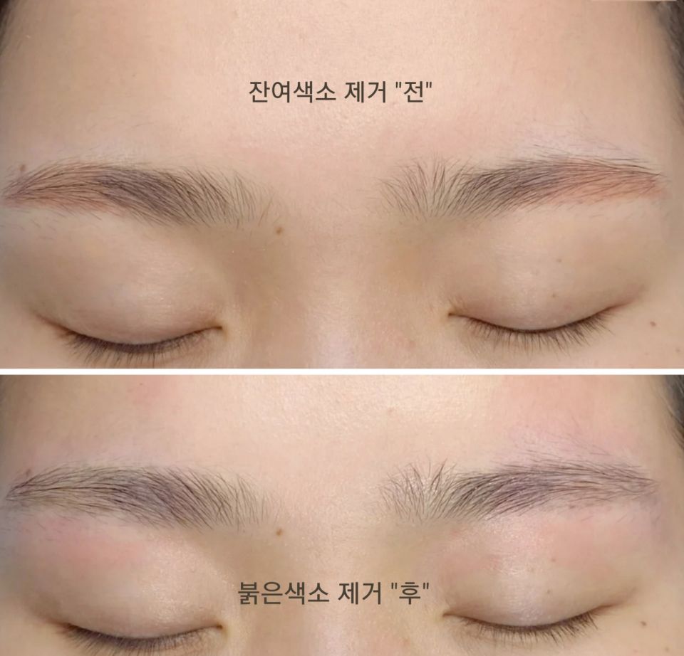 탑라인뷰티 이미지