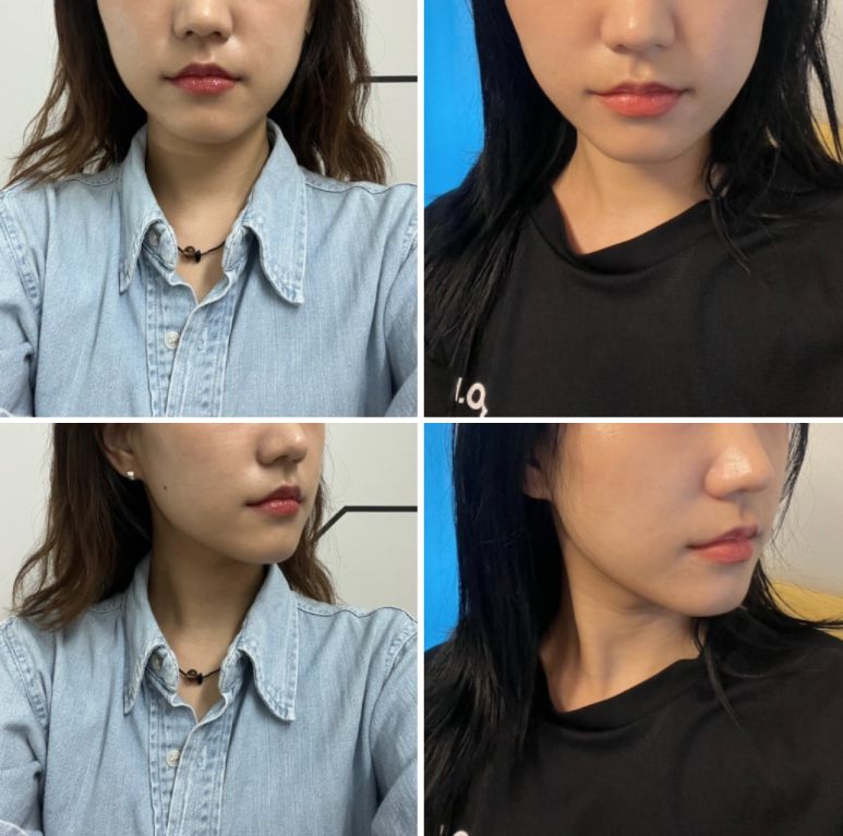 더웨이성형외과 이미지