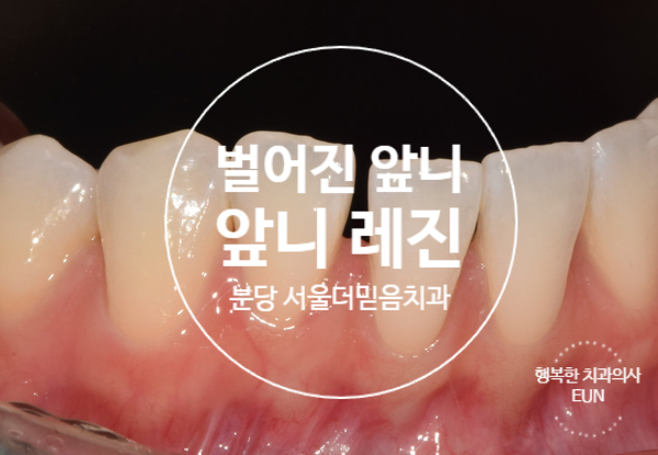 수지좋은치과의원 이미지