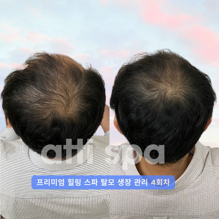 아띠헤어&스파 이미지