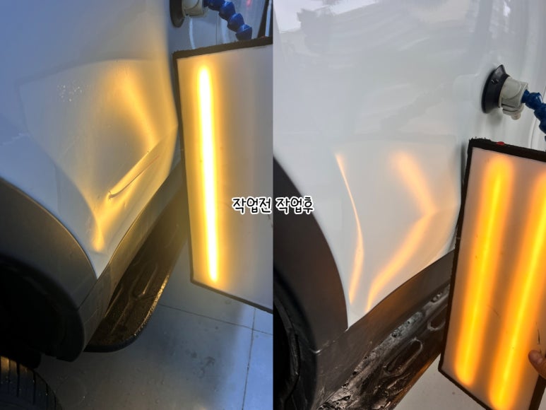 허덴트 이미지