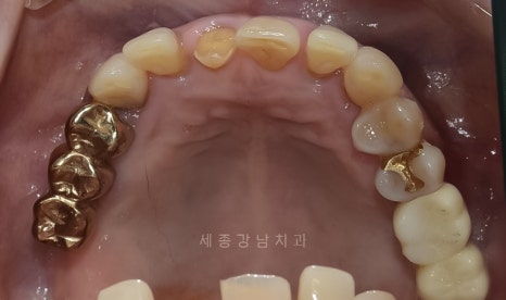 강남세종치과의원 이미지