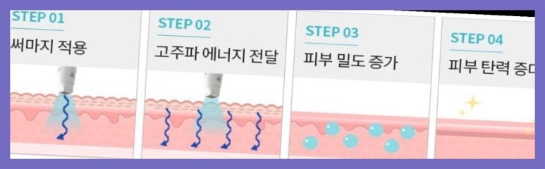 마렌에스테틱 이미지