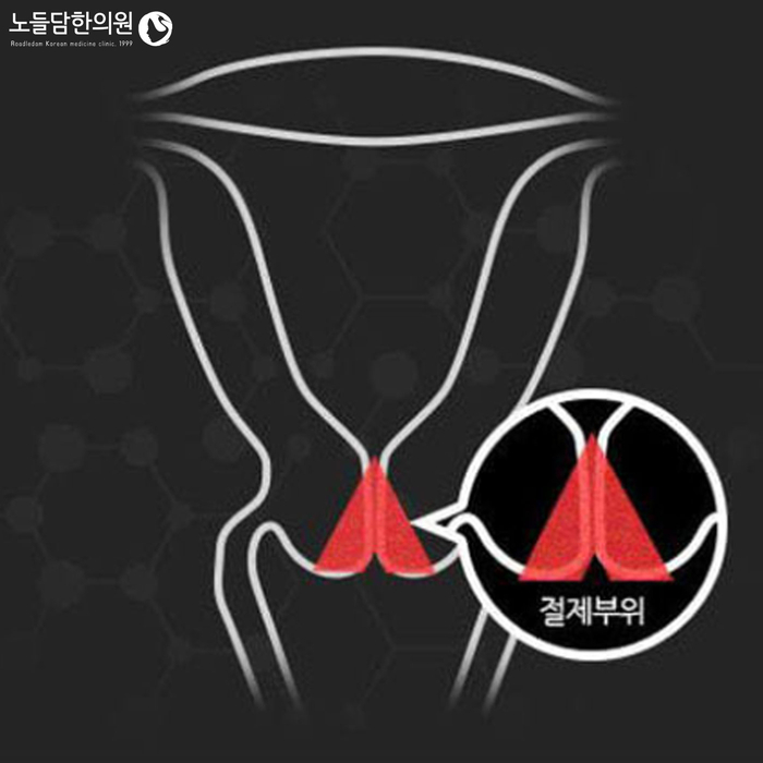 경부전기 이미지