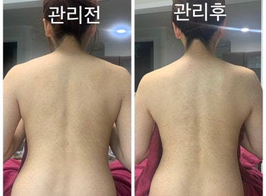 안양군포출장마사지 이미지