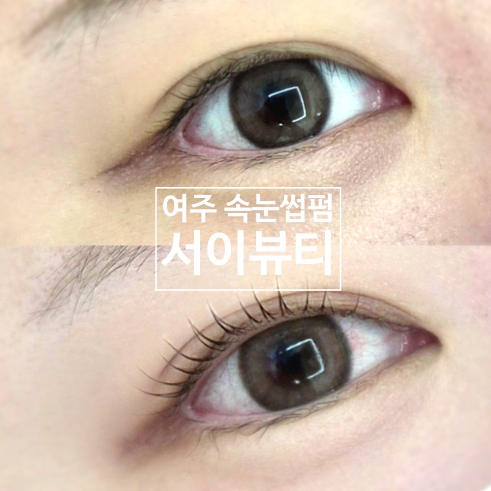 서이뷰티 이미지