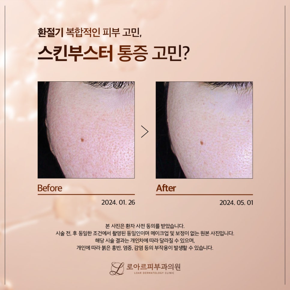 로아르피부과의원 이미지