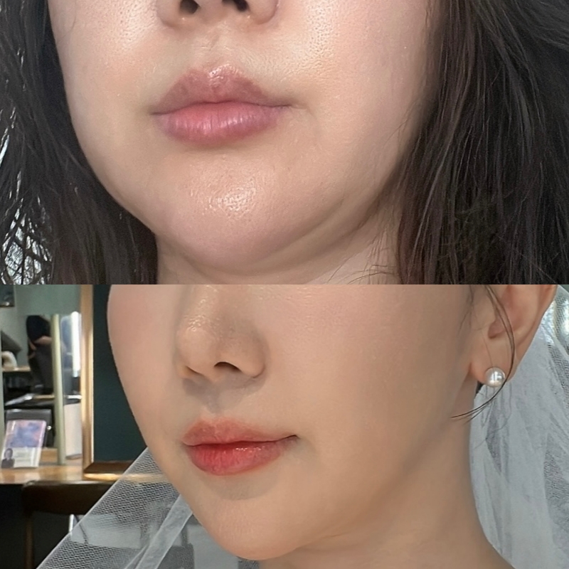 포아유에스테틱 이미지