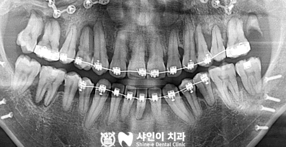 샤인이치과의원 이미지