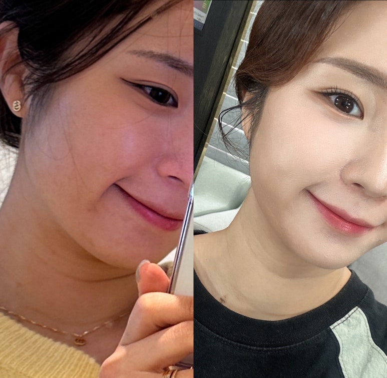 유라임 이미지