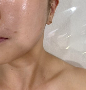 선 피부앤바디 이미지