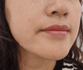 오르아즈 이미지