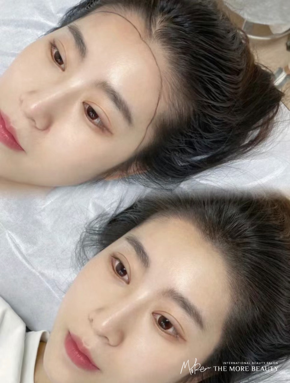 진헤어라인 이미지