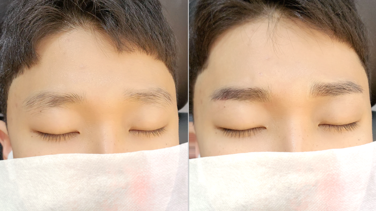 눈썹미인 이미지
