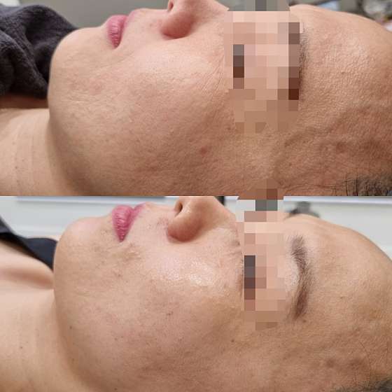 더고은 이미지