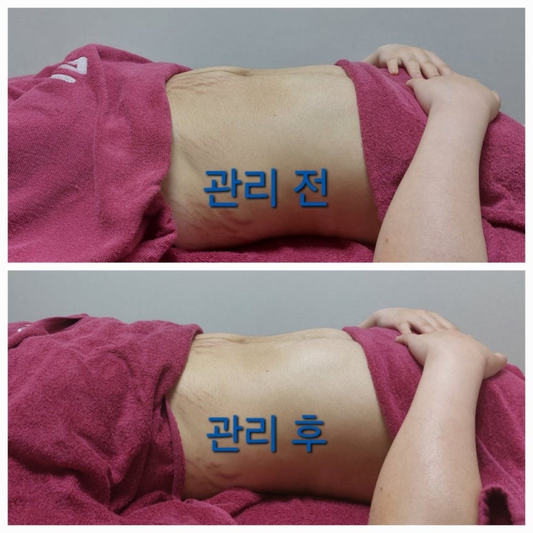 평택출장마사지 이미지