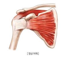 휴식공간운동요법 이미지