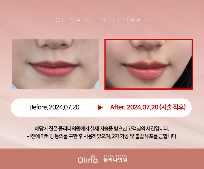올리나의원 이미지